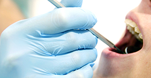 歯科医師（歯科検診）のイメージ